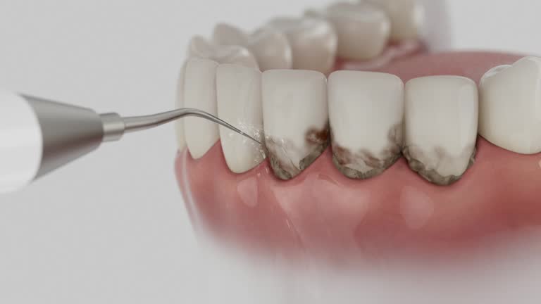 Trusted Teeth Whitening service in Uniontown, AL - Dentist Open Now